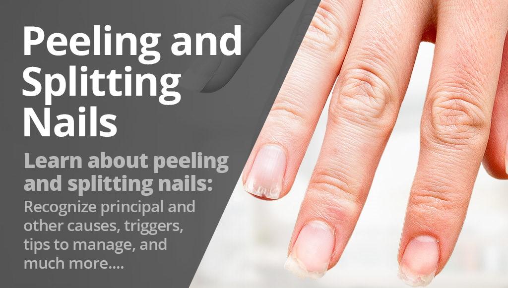 Breaking and Peeling Nails: Causes and Fixes